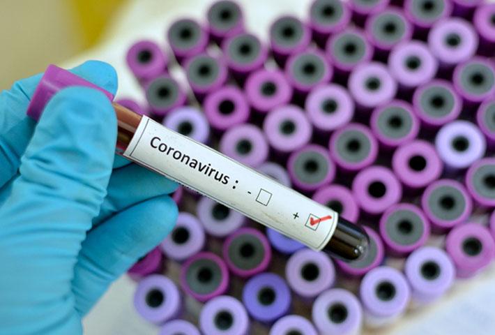 EL SISTEMA DE SALUD EN BOLIVIA EN TIEMPOS DE CORONAVIRUS